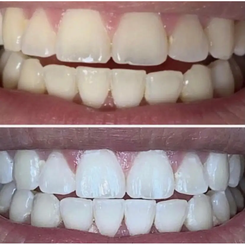 (2 pack) Nu Skin AP - 24 Whitening Fluoride Toothpaste