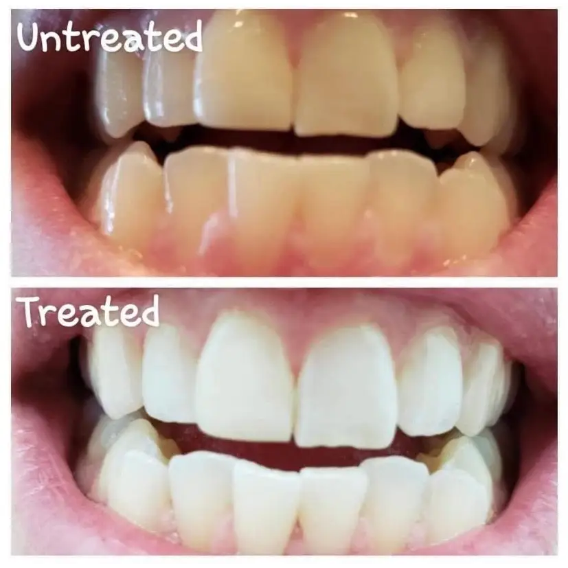 (2 pack) Nu Skin AP - 24 Whitening Fluoride Toothpaste