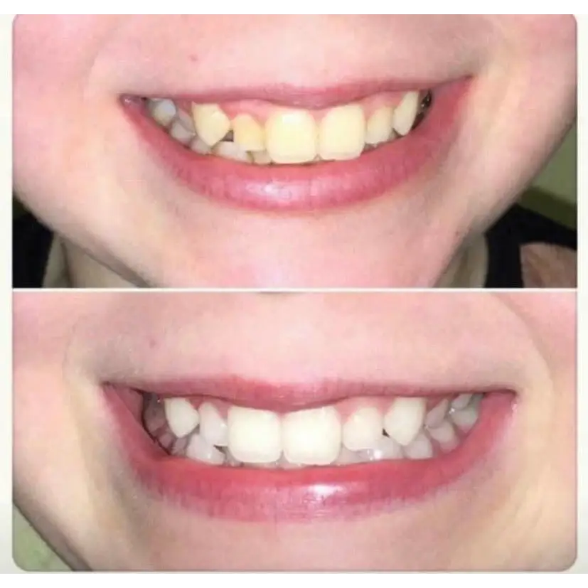 (2 pack) Nu Skin AP - 24 Whitening Fluoride Toothpaste