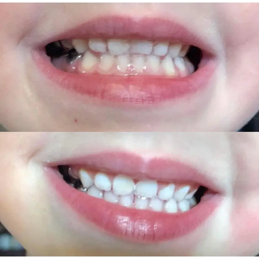 (2 pack) Nu Skin AP - 24 Whitening Fluoride Toothpaste